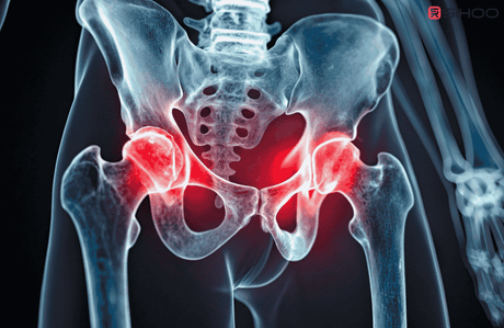 7 Ways Your Office Chair Might Be Harming Your Hips